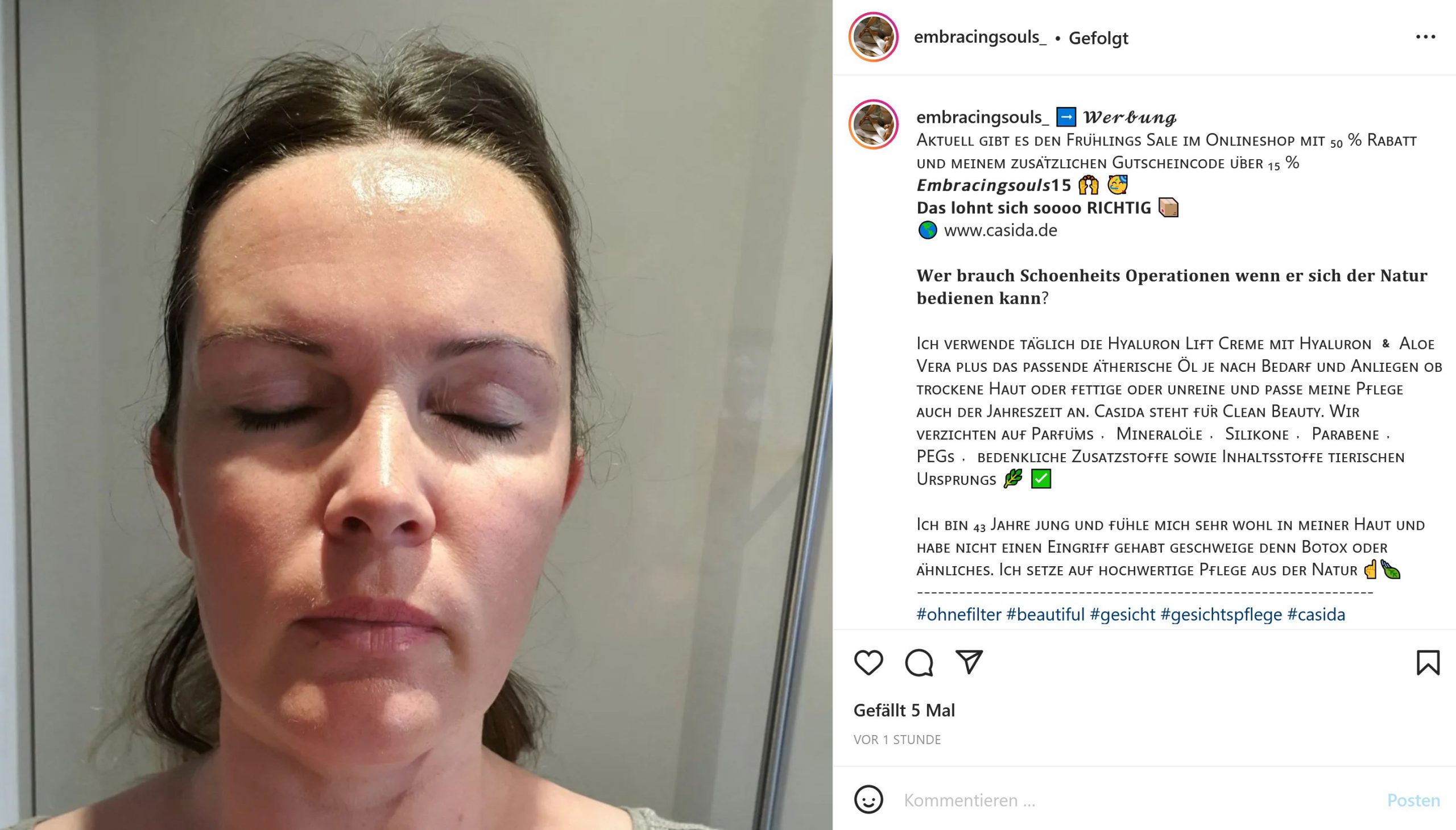 Bianca Döhring Rabatt Werbung Lügen Schönheit Gesicht Schönheits-OPs Botox Ätherische Öle Rabattcode Casida